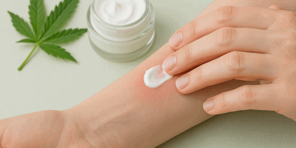Cremes com cannabis podem aliviar os sintomas de eczema, indica novo estudo